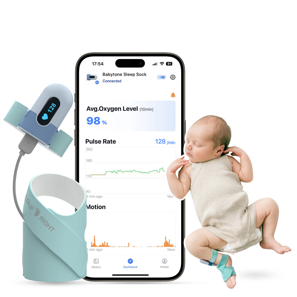 Baby Sleep Monitor S1 - Green Sock Version